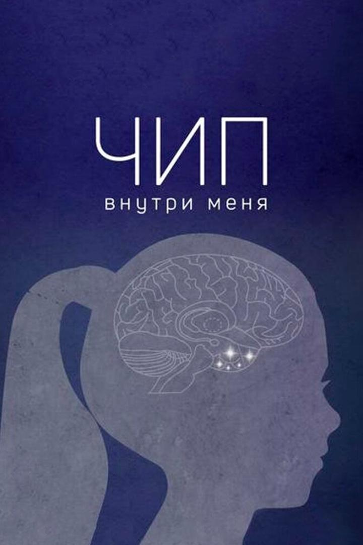 Чип внутри меня