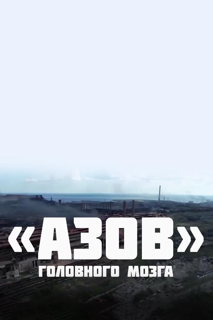 "Азов" головного мозга